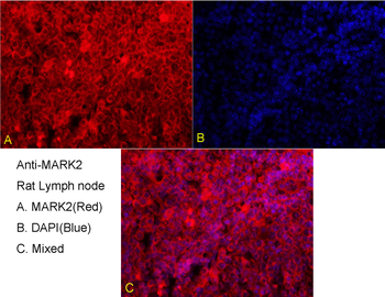 MARK2 Rabbit Polyclonal Antibody