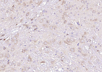 NUAK2 Rabbit Polyclonal Antibody
