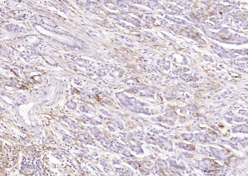 ACE2 Rabbit Polyclonal Antibody