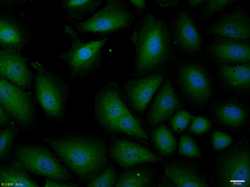 SQSTM1/P62 Rabbit Polyclonal Antibody