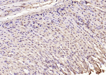 SQSTM1/P62 Rabbit Polyclonal Antibody