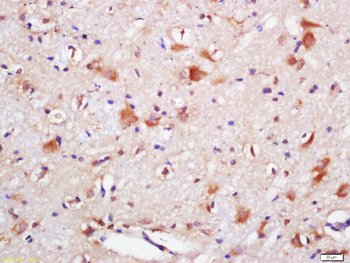 SQSTM1/P62 Rabbit Polyclonal Antibody