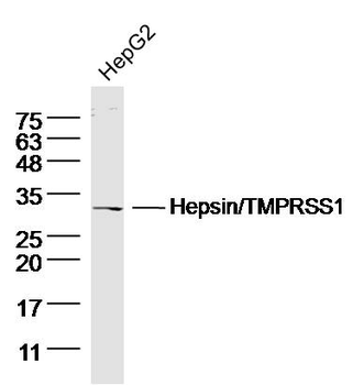 Hepsin/TMPRSS1 Rabbit Polyclonal Antibody