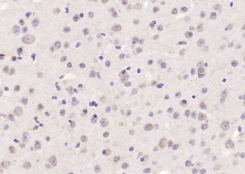 Acid Phosphatase Rabbit Polyclonal Antibody