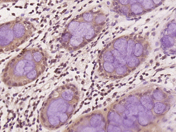 PAGE1 Rabbit Polyclonal Antibody