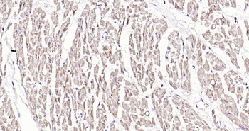 Calpastatin Rabbit Polyclonal Antibody