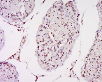 MAGEB1 Rabbit Polyclonal Antibody