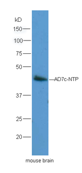 Neuronal thread protein AD7c-NTP Rabbit Polyclonal Antibody