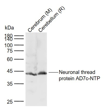 Neuronal thread protein AD7c-NTP Rabbit Polyclonal Antibody