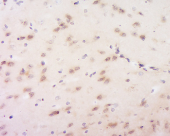 Neuronal thread protein AD7c-NTP Rabbit Polyclonal Antibody