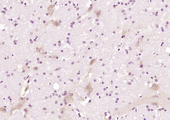 DEDD1 Rabbit Polyclonal Antibody