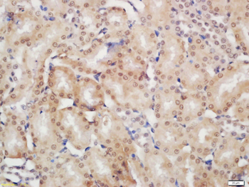 JMJD6 Rabbit Polyclonal Antibody