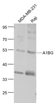 A1BG Rabbit Polyclonal Antibody