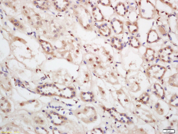 TIAF1 Rabbit Polyclonal Antibody