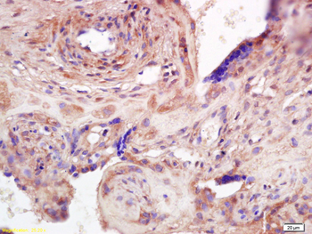 ADAMTS7 Rabbit Polyclonal Antibody
