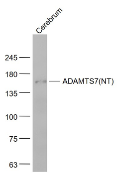 ADAMTS7 (NT) Rabbit Polyclonal Antibody