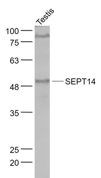 SEPT14 Rabbit Polyclonal Antibody