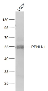 PPHLN1 Rabbit Polyclonal Antibody