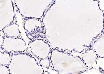 UBE2V1 Rabbit Polyclonal Antibody