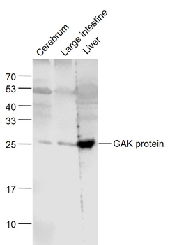 GAK protein Rabbit Polyclonal Antibody