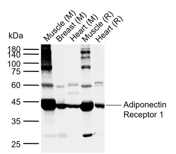 Adiponectin Receptor 1 Rabbit Polyclonal Antibody