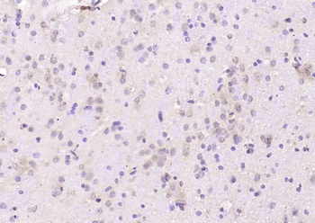 Ran Rabbit Polyclonal Antibody