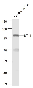 ST14 Rabbit Polyclonal Antibody