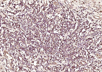 RBM3 Rabbit Polyclonal Antibody