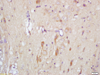 Slitrk1 Rabbit Polyclonal Antibody
