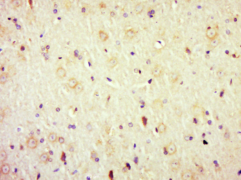ADRA2 Rabbit Polyclonal Antibody