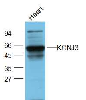 GIRK1/KCNJ3 Rabbit Polyclonal Antibody