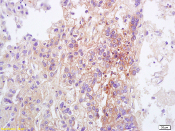 TRPC3 Rabbit Polyclonal Antibody