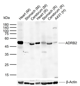 ADRB2 Rabbit Polyclonal Antibody