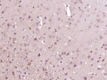 EphA3 Rabbit Polyclonal Antibody