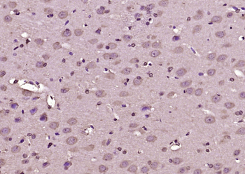 Galactosidase alpha Rabbit Polyclonal Antibody