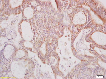 Galactosidase alpha Rabbit Polyclonal Antibody