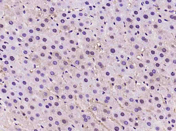 A1CF Rabbit Polyclonal Antibody