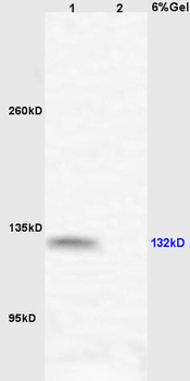 HIPK2 Rabbit Polyclonal Antibody