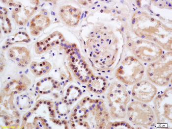 HIPK2 Rabbit Polyclonal Antibody