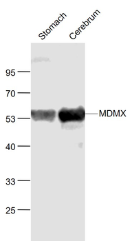 MDMX Rabbit Polyclonal Antibody