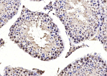MIS12 Rabbit Polyclonal Antibody