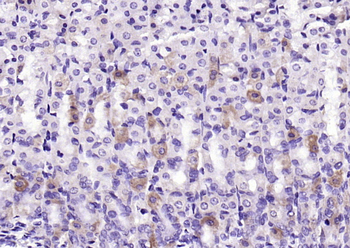 KLHL9 Rabbit Polyclonal Antibody