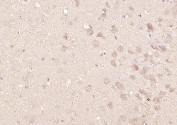 HCF-1 Rabbit Polyclonal Antibody