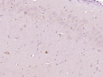 RAGE Rabbit Polyclonal Antibody