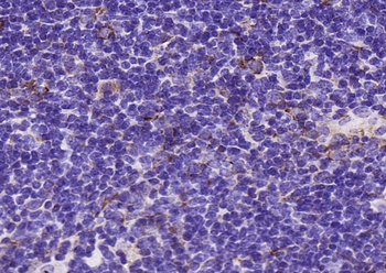VHL Rabbit Polyclonal Antibody