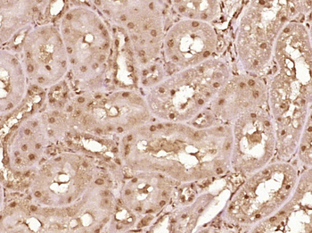 VHL Rabbit Polyclonal Antibody