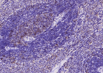 VHL Rabbit Polyclonal Antibody