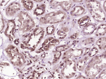SRPK2 Rabbit Polyclonal Antibody