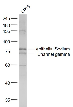 Epithelial Sodium Channel gamma Rabbit Polyclonal Antibody