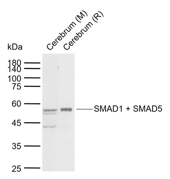 SMAD1 + SMAD5 Rabbit Polyclonal Antibody